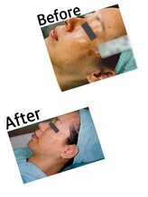 エスティ 京都店/☆