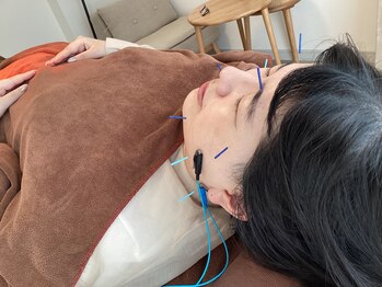 ハリファ鍼灸院 横浜関内院(HariFa鍼灸院)/美容施術