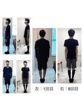 シンメトリー 千葉店/☆シンメトリー美容矯正