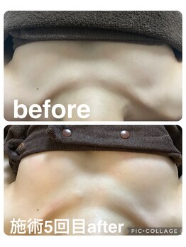 ギンザアール(GINZA R.)/バストケアに◎