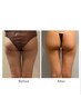今だけ【ボディ人気No.1】新脂肪燃焼剤10ml導入×Bodyシェイプ