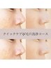 お手軽に♪毛穴洗浄クイックケアコース★￥7500