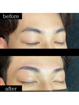 ユー 千葉駅前店(you)/ビフォーアフター写真