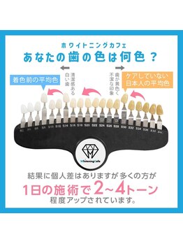 ホワイトニングカフェ 盛岡大通店(WhiteningCafe)/★あなたの歯の色は？★