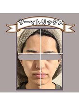 ビーマジック(美magic)/サーマトリックス