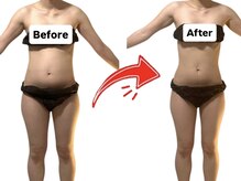 ヨサパーク アリー 湘南台(YOSA PARK ARI)の雰囲気（気になるお腹、脚引き締めで喜びの結果！）