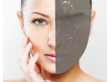 コル(COR)/ゼオライト水素マスク