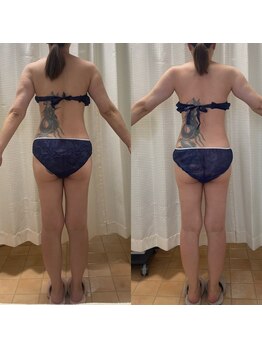 エン ボディアンドフェイシャル(En)/NEW☆ハイパーナイフ痩身・全身