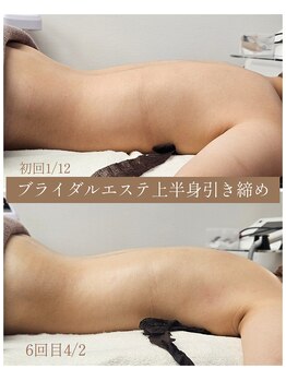 リブラン(Libran)/スッキリ上半身でドレス映え♪