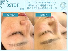 フローフシ∞/フェイシャルトータルケア