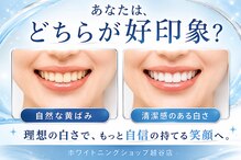 ホワイトニングショップ 越谷店