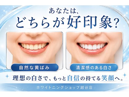 ホワイトニングショップ 越谷店の写真