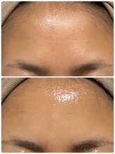 ソラウミ(SORAUMI)/何歳からでも艶肌に！