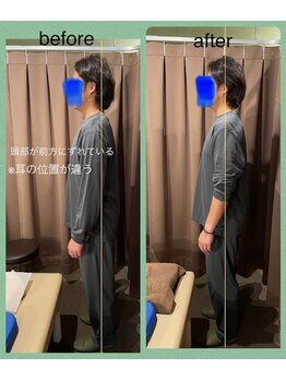 アイリー(Irie)/骨格矯正