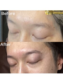 眉毛ハウス 吉祥寺店(眉毛HOUSE)/お客様の施術例(吉祥寺/東京)