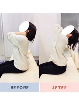 ナオル整体 三鷹院(NAORU整体)/20代女性施術事例【胸椎伸展】