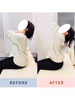 ナオル整体 三鷹院(NAORU整体)/20代女性施術事例【胸椎伸展】