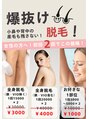 モミ(MOMI)&nbsp;好きな部位を選んで２回で1000円！やるしかない！