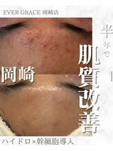 リラベル(Lira Belle)/敏感肌も変わります！