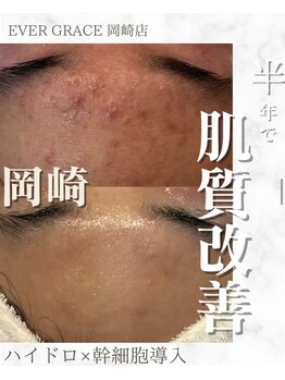 リラベル(Lira Belle)/敏感肌も変わります！