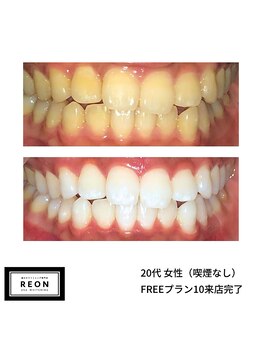 レオン 磐田(REON)/◇ お客様 before＆after ◇