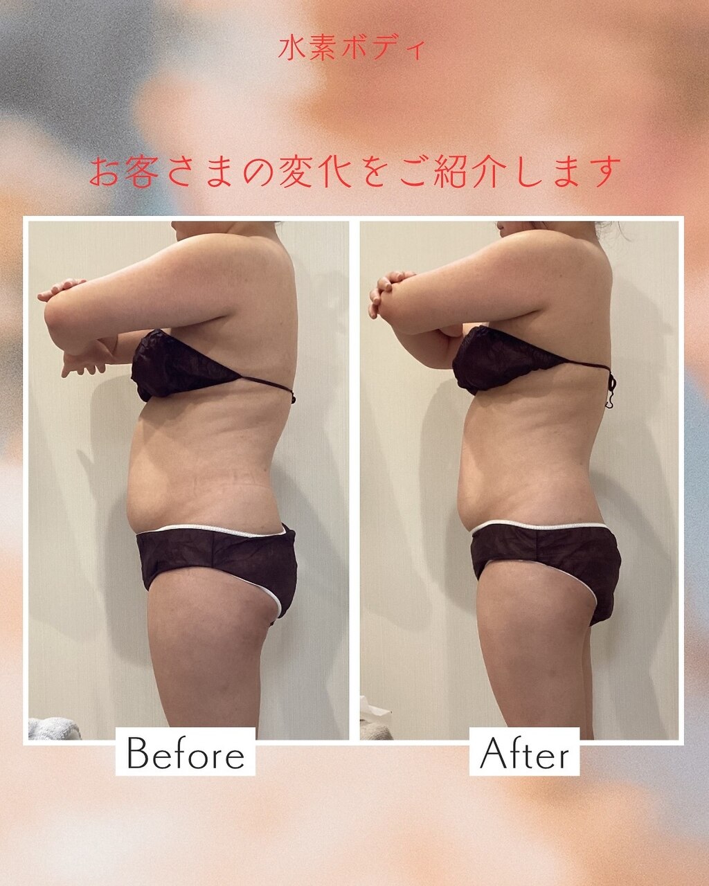 【6月限定】水素吸入＋エステでむくみスッキリ痩身効果!ボディ80分22,000円→