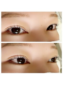 アアルズ(R’s)/