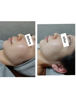 イージープラス つくば店(EASY+)/光フェイシャル