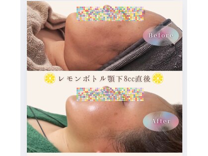 ナナイロ(nanairo)の写真