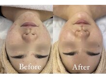 アルマサロン 菊陽(Almasalon)/【HAAB REPRO】ハーブリプロ