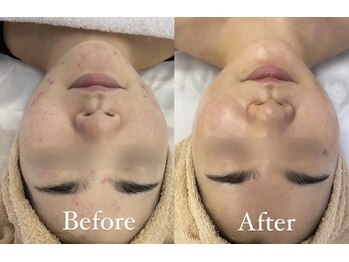 アルマサロン 菊陽(Almasalon)/【HAAB REPRO】ハーブリプロ