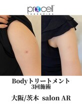 サロン アール(salon AR)/プロセルセラピーズ