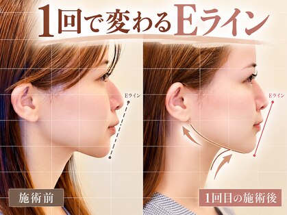 リストアハート(Restore Heart)の写真