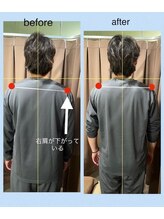 アイリー(Irie)/骨格矯正