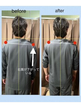 アイリー(Irie)/骨格矯正