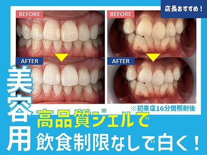 ホワイトニングカフェ 相模大野店(WhiteningCafe)の写真