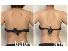 ユヴィラ(YUVIRA)/むくみ・老廃物ドバドバ流れる！