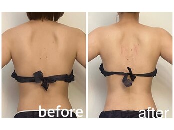 ユヴィラ(YUVIRA)/むくみ・老廃物ドバドバ流れる！