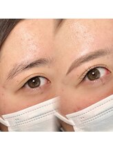 チル アンド アイ 船橋駅前店(Chill&Eye)/美眉スタイリング/BeforeAfter