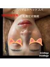 レモングラス/ヘッドスパなのにお顔があがる！