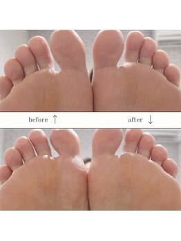 ザ ヴォーグ(the VOGUE)/足裏悩み解決