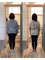 ハル鍼灸整骨院 池田院(HALU鍼灸整骨院)&nbsp;【産後矯正】四か月でマイナス5キロ産前より引き締まった身体に