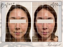 トーティシェル(tortoise shell)/ハリつやUP