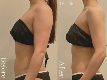 ユーフォリア グロウ(euphoria glow)/{ ラフォス痩身90分 10回 }