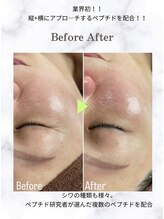 リノア 堀江(Linoa)/毛穴洗浄＆水光肌ピーリング