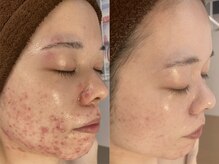 エヌエースキン たまプラーザ店(NAskin)の雰囲気（フォトギャラリーにお客様から多いご質問まとめております♪横浜）