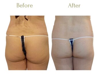 セレブリボーン 大阪ボーテ/デスクワークあるある垂尻