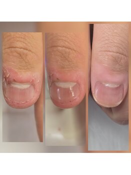 ネイル アトリエ アミュレット(Amulet)/自爪育成と爪周りのケア