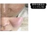 【たるみ くすみ シワ悩み逆転】内側から艶、ハリが生まれる肌～幹細胞Lit～