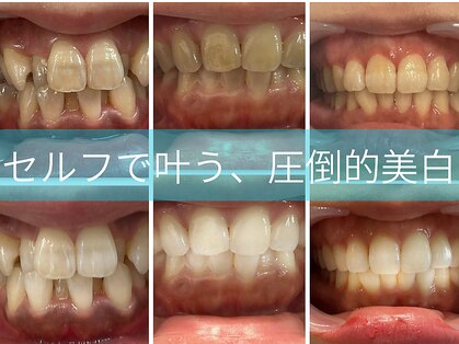 スマイルホワイトの写真